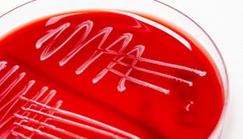Data analysis carried out by smartfood R&D prevents Listeria outbreak 